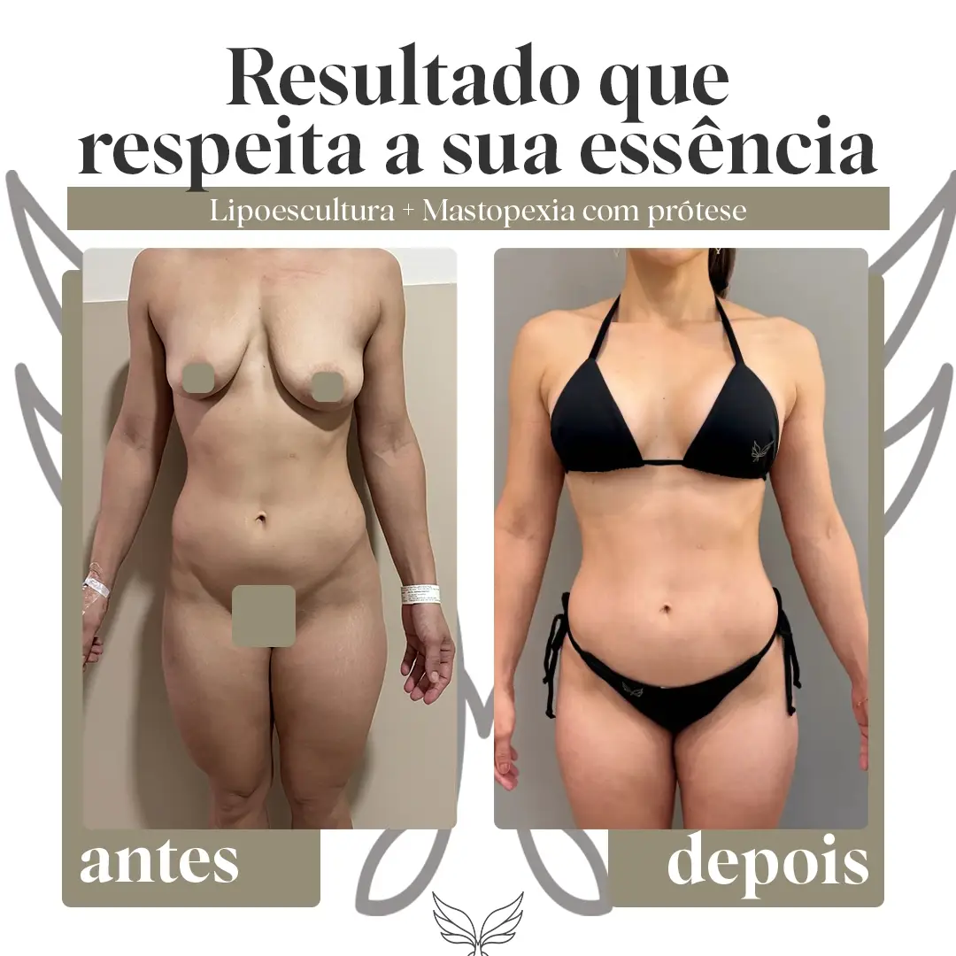 Antes e depois, registro autorizado pela paciente