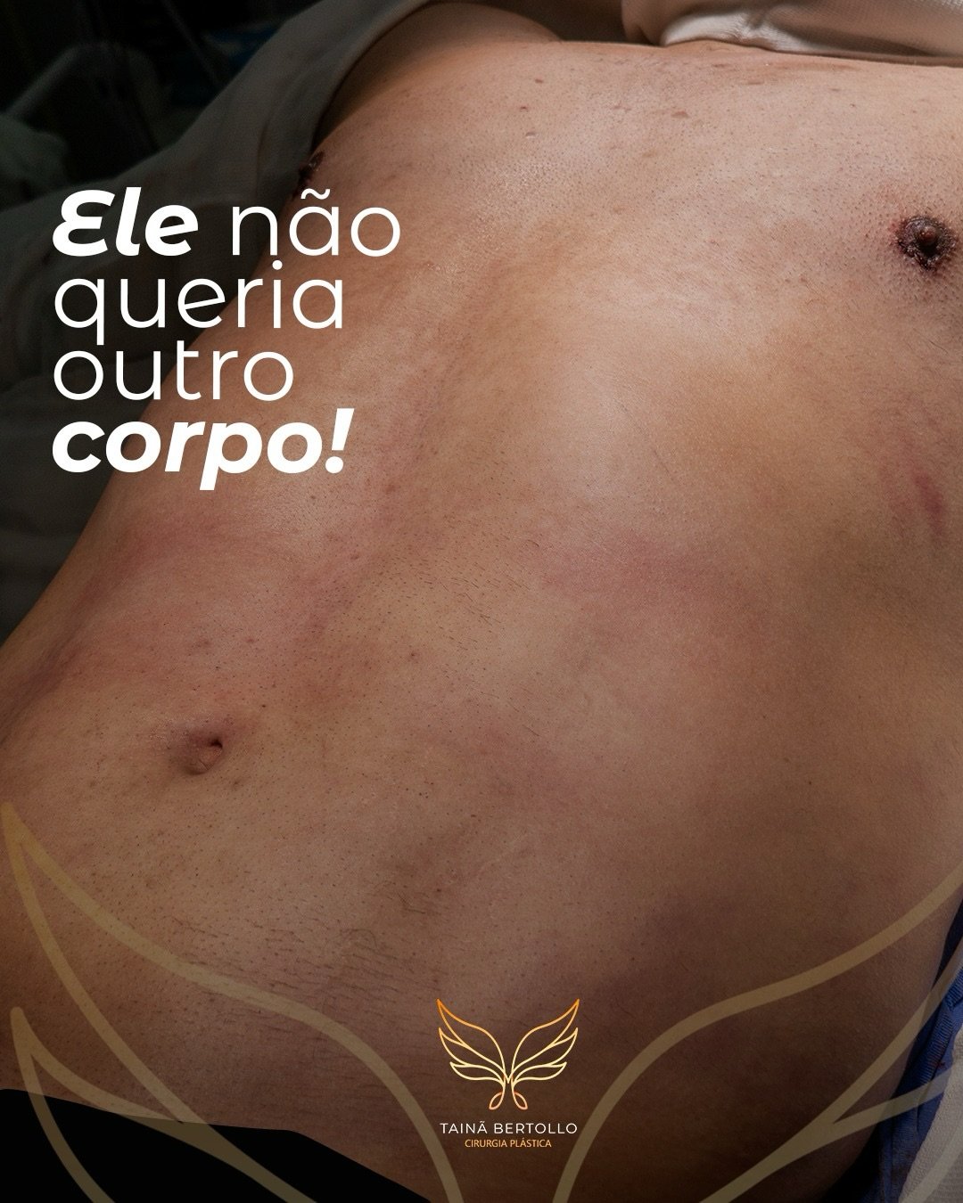 Antes e depois, registro autorizado pela paciente