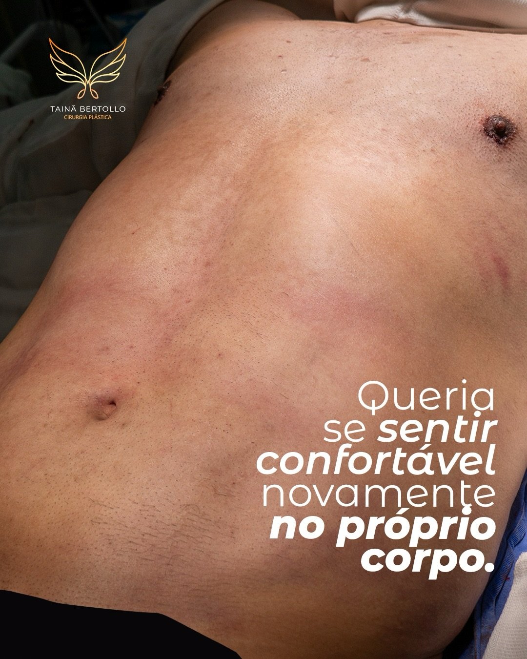 Antes e depois, registro autorizado pela paciente