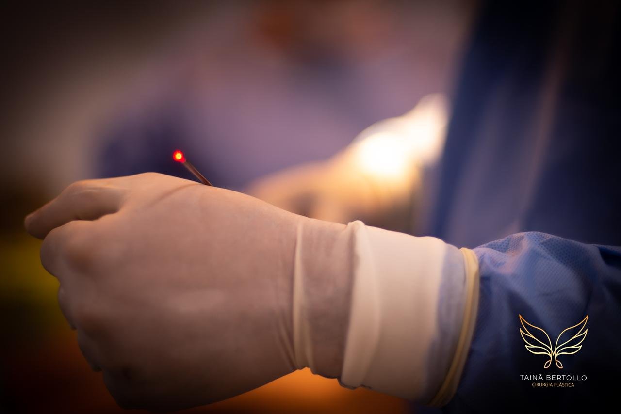 Resultado de cirurgia plástica, registro autorizado pela paciente
